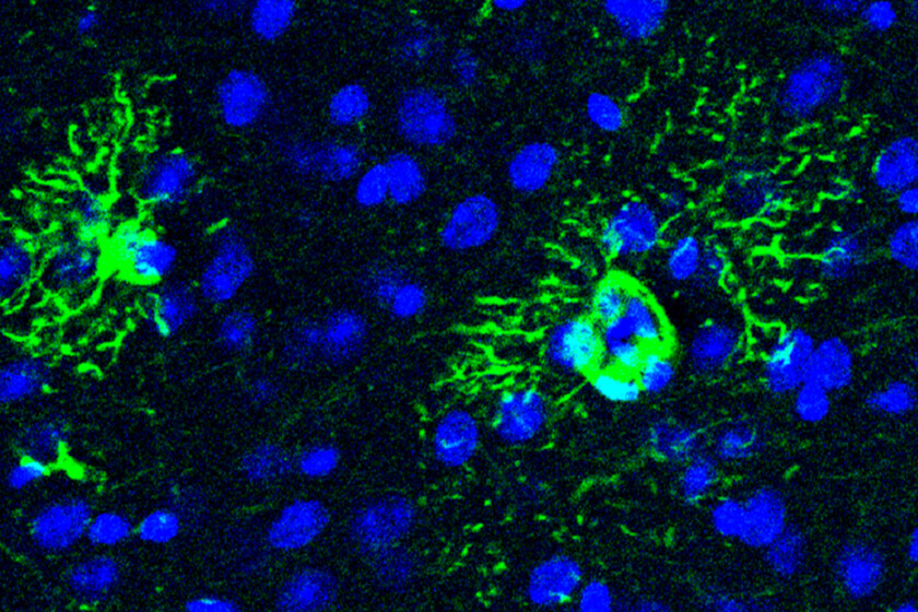 Alzheimer comienza mucho antes de sus síntomas. Y hemos descubierto uno de sus primeros mecanismos