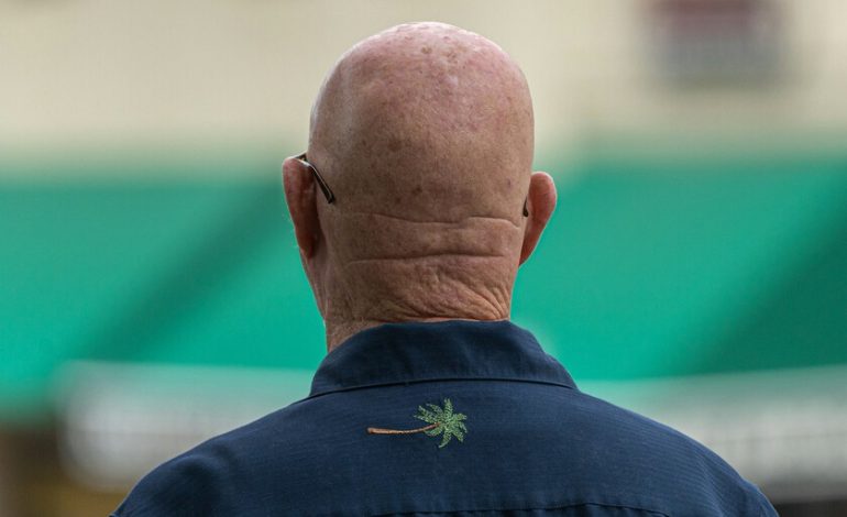 Minoxidil parecía el gran medicamento milagroso contra la calvicie. Una compañía farmacéutica financiada por Google acaba de superarlo
– El diario andino