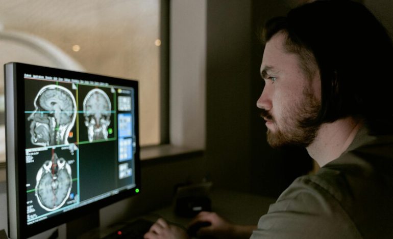 Lo que sabemos sobre los riesgos de sufrir un derrame cerebral siendo joven
– El diario andino