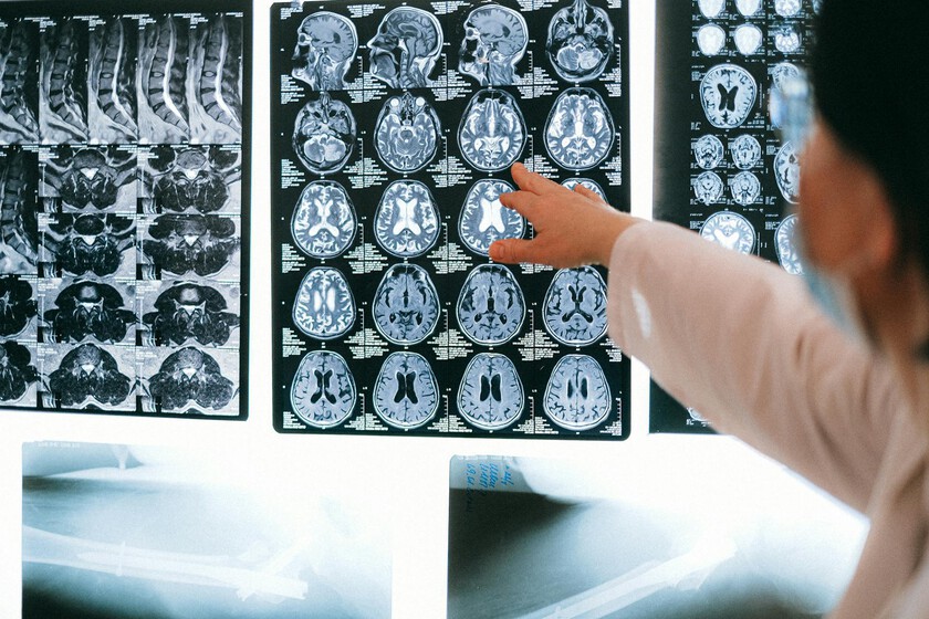 Los golpes se han convertido en un gran problema de salud silencioso en España. Y hay formas de limitar los riesgos

 – El diario andino