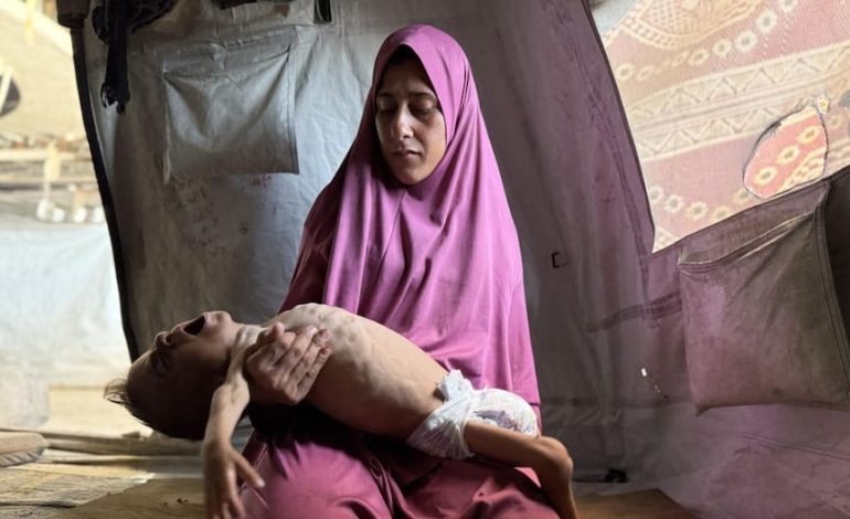 La desnutrición mata a cinco gazatis, incluido un bebé y 2 hijos, en las últimas 24 horas
– El diario andino