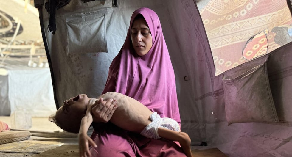 La desnutrición mata a cinco gazatis, incluido un bebé y 2 hijos, en las últimas 24 horas

 – El diario andino