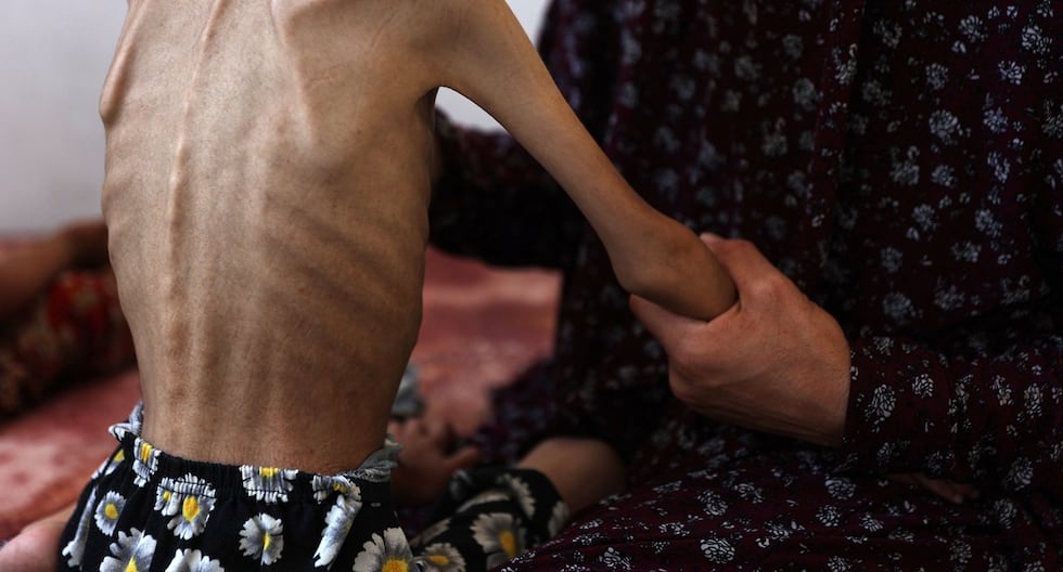 Guerra Israel – Hamás en Gaza: Franja de Gaza Registro OTRAS SEIS MUERTES RELACONADAS CON EL HAMBRE Y SUMA AL MENOS 175 DECESOS | Palestina | Unrwa | GHF | Fundación humanitaria para gaza | ONU | Últimas | Mundo
 – El diario andino