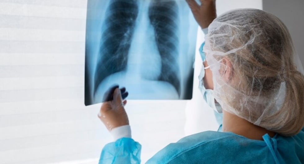 ¿Cómo puede una cirugía oncológica oportuna evitar la propagación del tumor a otros órganos? | PERÚ

 – El diario andino