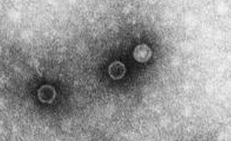 Aniversarios del 2 de noviembre: ¿Qué pasó en el mundo un día como hoy? | Carlton-Schwerdt | Schäfer | Poliomielitis | Estados Unidos más reciente | MUNDO
– El diario andino