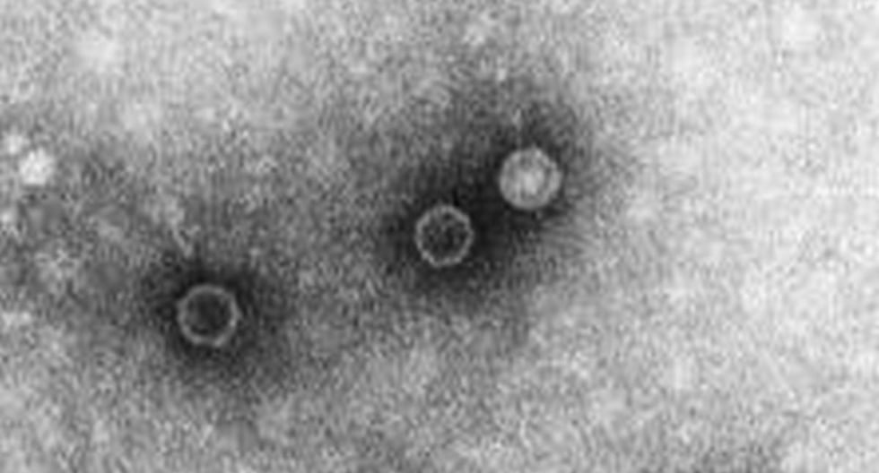 Aniversarios del 2 de noviembre: ¿Qué pasó en el mundo un día como hoy? | Carlton-Schwerdt | Schäfer | Poliomielitis | Estados Unidos más reciente | MUNDO

 – El diario andino