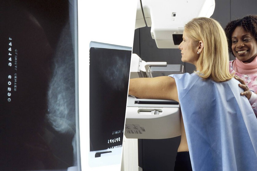 El mayor ensayo clínico confirma que detecta más y reduce la carga del radiólogo

 – El diario andino