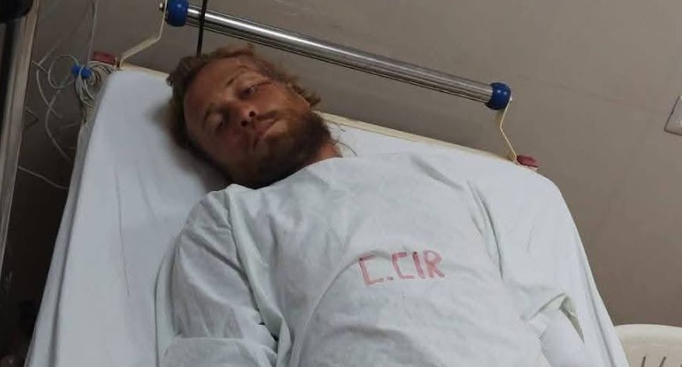 Áncash: piden apoyo para ciclista ruso que fue atropellado por conductor que se dio a la fuga | PERÚ

 – El diario andino