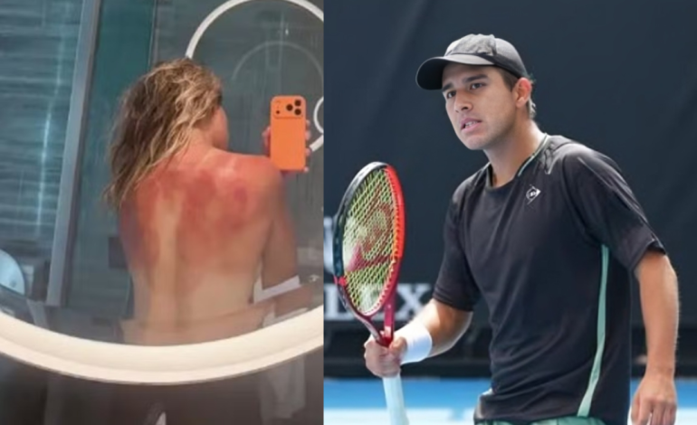 Tras la eliminación de Gonzalo Bueno, se reportan quemaduras solares en el Abierto de Australia

 – El diario andino