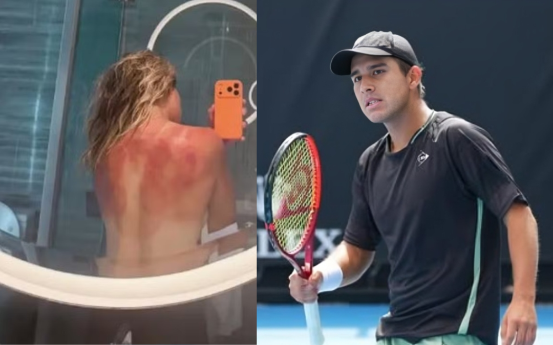 Tras la eliminación de Gonzalo Bueno, se reportan quemaduras solares en el Abierto de Australia

 – El diario andino