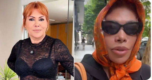 Conductor regresa a Lima luego de someterse a una cirugía estética en Argentina –

 – El diario andino