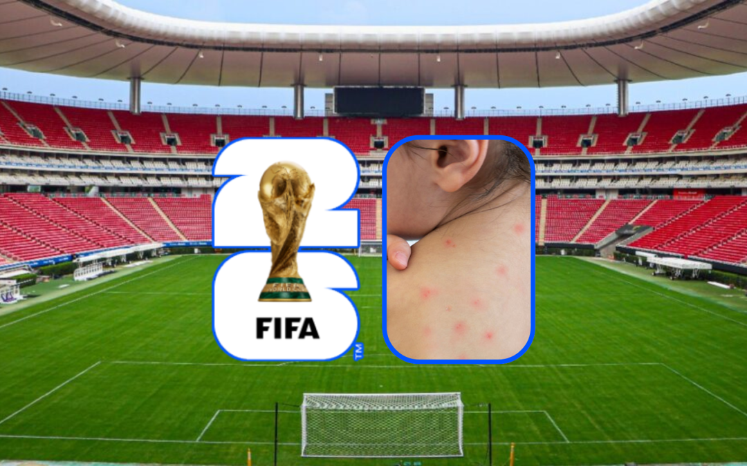 ¡Alerta BROTE DE SARAMPIÓN amenaza el Mundial 2026!

 – El diario andino